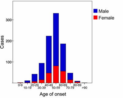 Alter bei Beginn der Dupuytren-Krankheit bei Männern und Frauen